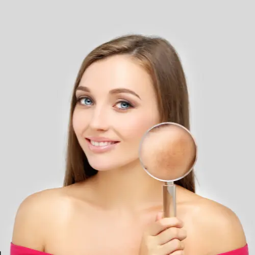 Tratamiento Melasma Santo Domingo,DN